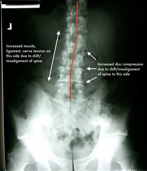 hentai x-ray|Hentai xray Search